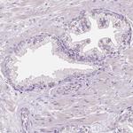 DNAH12 Antibody in Immunohistochemistry (IHC)