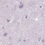 DNAH12 Antibody in Immunohistochemistry (IHC)