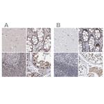 RAP80 Antibody in Immunohistochemistry (IHC)