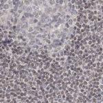 RAP80 Antibody in Immunohistochemistry (IHC)