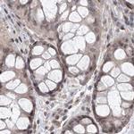 RAP80 Antibody in Immunohistochemistry (IHC)