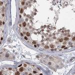 RAP80 Antibody in Immunohistochemistry (IHC)