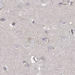 RAP80 Antibody in Immunohistochemistry (IHC)