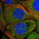 DDO Antibody in Immunocytochemistry (ICC/IF)