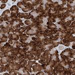 MMADHC Antibody in Immunohistochemistry (Paraffin) (IHC (P))