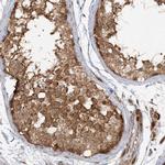 MMADHC Antibody in Immunohistochemistry (IHC)