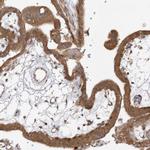 MMADHC Antibody in Immunohistochemistry (IHC)