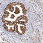 MMADHC Antibody in Immunohistochemistry (IHC)