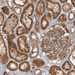 MMADHC Antibody in Immunohistochemistry (IHC)