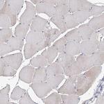 EPB41L5 Antibody in Immunohistochemistry (Paraffin) (IHC (P))