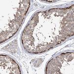 EPB41L5 Antibody in Immunohistochemistry (Paraffin) (IHC (P))