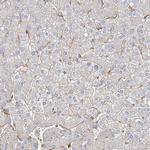 WDR37 Antibody in Immunohistochemistry (IHC)