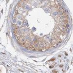 WDR37 Antibody in Immunohistochemistry (IHC)