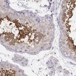 SPA17 Antibody in Immunohistochemistry (IHC)