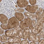 PCBD1 Antibody in Immunohistochemistry (Paraffin) (IHC (P))