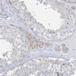 PCBD1 Antibody in Immunohistochemistry (Paraffin) (IHC (P))