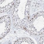 RPP30 Antibody in Immunohistochemistry (Paraffin) (IHC (P))