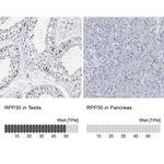 RPP30 Antibody in Immunohistochemistry (IHC)