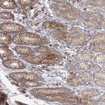 THNSL1 Antibody in Immunohistochemistry (Paraffin) (IHC (P))