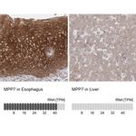 MPP7 Antibody in Immunohistochemistry (IHC)