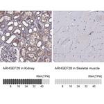 ARHGEF28 Antibody in Immunohistochemistry (IHC)