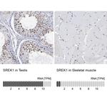 SFRS12 Antibody in Immunohistochemistry (IHC)