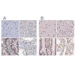 SFRS12 Antibody in Immunohistochemistry (IHC)