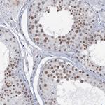 SFRS12 Antibody in Immunohistochemistry (IHC)