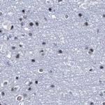 SFRS12 Antibody in Immunohistochemistry (IHC)