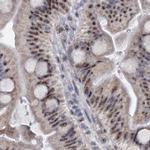 SFRS12 Antibody in Immunohistochemistry (IHC)