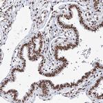 QRICH1 Antibody in Immunohistochemistry (Paraffin) (IHC (P))