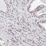 QRICH1 Antibody in Immunohistochemistry (Paraffin) (IHC (P))