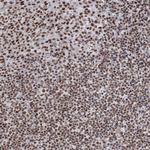 QRICH1 Antibody in Immunohistochemistry (Paraffin) (IHC (P))