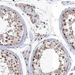 QRICH1 Antibody in Immunohistochemistry (IHC)