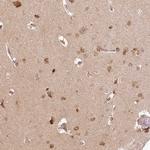 INPP4B Antibody in Immunohistochemistry (Paraffin) (IHC (P))