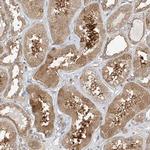 INPP4B Antibody in Immunohistochemistry (Paraffin) (IHC (P))