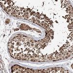 INPP4B Antibody in Immunohistochemistry (IHC)