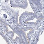 RFX6 Antibody in Immunohistochemistry (Paraffin) (IHC (P))