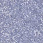 RFX6 Antibody in Immunohistochemistry (Paraffin) (IHC (P))