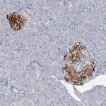 RFX6 Antibody in Immunohistochemistry (Paraffin) (IHC (P))