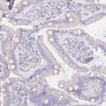 Rbm20 Antibody in Immunohistochemistry (Paraffin) (IHC (P))