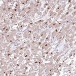 Rbm20 Antibody in Immunohistochemistry (IHC)