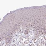 Rbm20 Antibody in Immunohistochemistry (IHC)