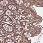 LSG1 Antibody in Immunohistochemistry (Paraffin) (IHC (P))