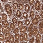 LSG1 Antibody in Immunohistochemistry (Paraffin) (IHC (P))