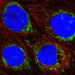 ACAD9 Antibody in Immunocytochemistry (ICC/IF)