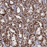 ACAD9 Antibody in Immunohistochemistry (Paraffin) (IHC (P))