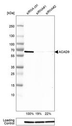 ACAD9 Antibody in Western Blot (WB)