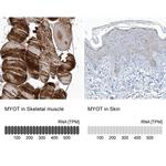 Myotilin Antibody in Immunohistochemistry (IHC)