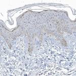 Myotilin Antibody in Immunohistochemistry (IHC)